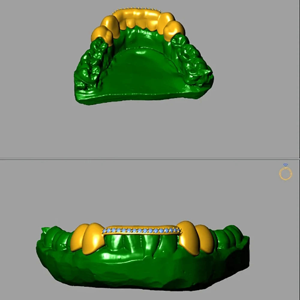 925 Silver VVS Grillz Iced Out Diamond 1-Row