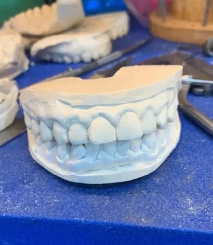 925 Silver VVS Moissanite Grillz Iced Out