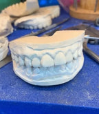 925 Silver VVS Moissanite Grillz Iced Out